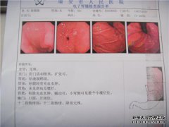 糜烂性胃炎如何分类？