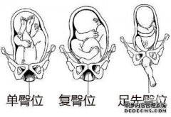 美军是否退出了步伐？目前，叙利亚民族的目标