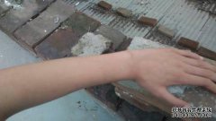 为什么我的阴茎不勃起？