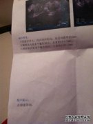 宫腔镜检查是什么意思？