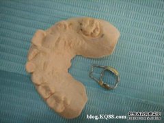 您是否需要支持孩子的乳齿间隙？