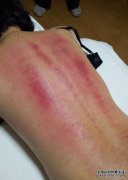你能检查女人背部的身体状况吗？