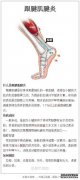 富含血小板的血浆和肌腱干细胞的混合物参与了