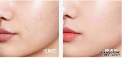 如何使您的脸庞粗糙细腻？如何改善脸部表情？