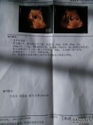不检查方式