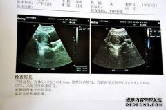 你好46mm直径。前后直径是31