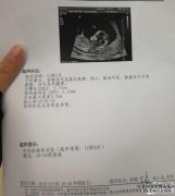 怀孕12周，昨天，根据BNT超声检查正常，头和腰部